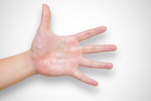 How to Handle Sweaty Hands